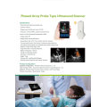 Color Doppler Tablet Ultrasound Handheld Color Ultrasound Scanner Android Ultrasound Probe